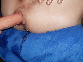 Major prostate culminate